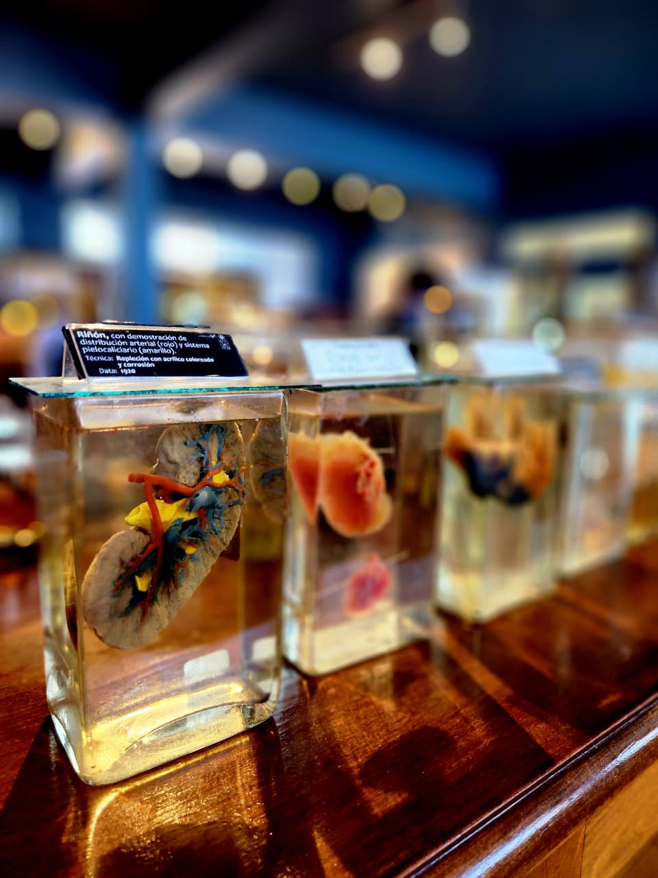 La extrañeza de los cuerpos: El Museo de Anatomía de la Universidad de&nbsp;Chile